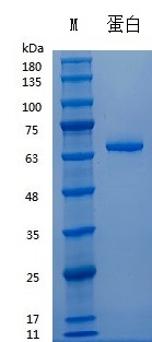 Y01311 Recombinant Human Fibronectin.jpg