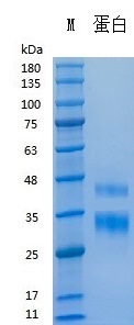 Y03501 Recombinant Human R-Spondin1.jpg