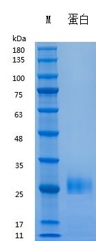 Y01801 Recombinant Human IFNγ.jpg