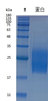 Y01501 Recombinant Human GM-CSF.jpg