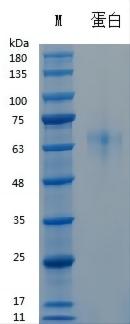 Y04801 Recombinant Human Vitronectin.jpg