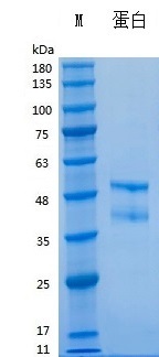 Y02903 Recombinant Human IL21(hFc Tag).jpg