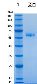 Y05001 Recombinant Human lL23.jpg