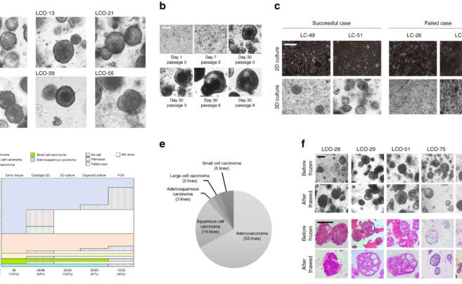 文献速读 | 患者来源的肺癌器官组织作为体外癌症模型用于治疗筛选